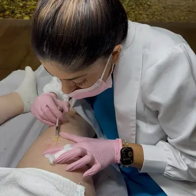 Dra. Thamara Martins, de jaleco e luvas, fazendo a aplicação de microvasos na perna de uma paciente